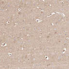 Anti-MAPK1 Antibody