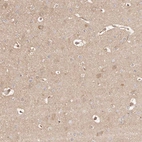 Anti-MAPK1 Antibody