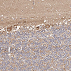 Immunohistochemical staining of human cerebellum shows moderate cytoplasmic positivity in Purkinje cells.