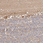 Immunohistochemical staining of human cerebellum shows moderate cytoplasmic positivity in Purkinje cells.