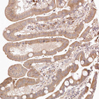 Immunohistochemical staining of human duodenum shows moderate cytoplasmic positivity in glandular cells.
