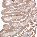 Immunohistochemical staining of human duodenum shows moderate cytoplasmic positivity in glandular cells.