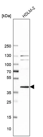 Western blot analysis in human cell line HDLM-2.
