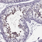 Immunohistochemical staining of human testis shows moderate membranous positivity in subset of cells in seminiferous ducts.