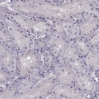 Immunohistochemical staining of human kidney shows no positivity in cells in tubules as expected.