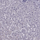 Immunohistochemical staining of human liver shows no positivity in hepatocytes as expected.