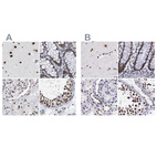 Anti-SF3A1 Antibody