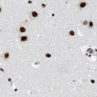 Immunohistochemical staining of human cerebral cortex using Anti-SF3A1 antibody HPA030083.