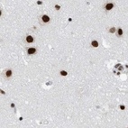 Anti-SF3A1 Antibody