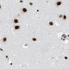 Immunohistochemical staining of human cerebral cortex using Anti-SF3A1 antibody HPA030083.