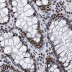 Immunohistochemical staining of human colon using Anti-SF3A1 antibody HPA030083.