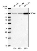 Western blot analysis in U2OS cells transfected with control siRNA, target specific siRNA probe #1 and #2, using Anti-SF3A1 antibody. Remaining relative intensity is presented.