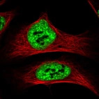 Immunofluorescent staining of human cell line U-2 OS shows localization to nuclear speckles.