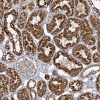 Anti-RAB11FIP3 Antibody