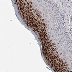 Anti-ZNF76 Antibody