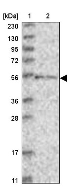 Lane 1: Marker [kDa] 230, 130, 95, 72, 56, 36, 28, 17, 11_br/_Lane 2: Human cell line RT-4