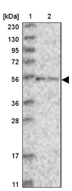 Lane 1: Marker [kDa] 230, 130, 95, 72, 56, 36, 28, 17, 11_br/_Lane 2: Human cell line RT-4