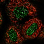 Immunofluorescent staining of human cell line A-431 shows localization to nucleoplasm & cytosol.