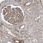 Immunohistochemical staining of human kidney shows strong cytoplasmic/ membranous positivity in cells in glomeruli.