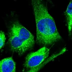 Immunofluorescent staining of human cell line U-251 MG shows localization to endoplasmic reticulum.