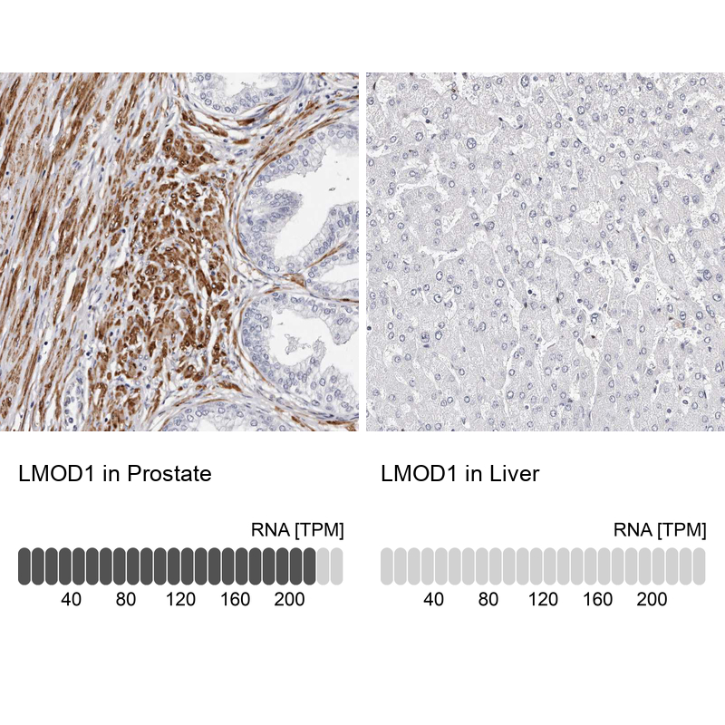 Anti-LMOD1 Antibody