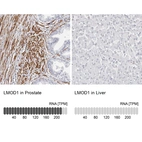 Anti-LMOD1 Antibody