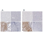 Immunohistochemical staining of human liver, pancreas, prostate and tonsil using Anti-LMOD1 antibody HPA030097 (A) shows similar protein distribution across tissues to independent antibody HPA028325 (B).