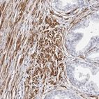 Immunohistochemical staining of human prostate shows strong cytoplasmic positivity in smooth muscle cells.