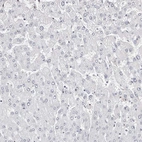 Immunohistochemical staining of human liver shows no positivity in hepatocytes as expected.