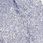 Immunohistochemical staining of human tonsil shows no positivity in non-germinal center cells as expected.