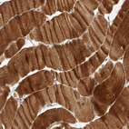 Anti-RNF187 Antibody