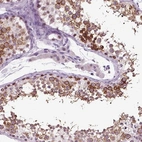 Immunohistochemical staining of human testis shows high expression.
