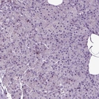 Immunohistochemical staining of human pancreas shows low expression as expected.
