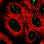 Immunofluorescent staining of human cell line MCF7 shows localization to nucleoli.