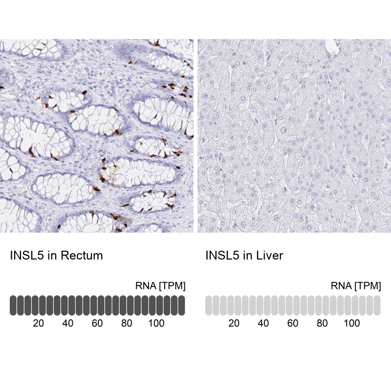 Anti-INSL5 Antibody
