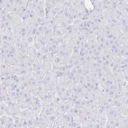 Immunohistochemical staining of human liver shows low expression as expected.