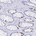 Immunohistochemical staining of human rectum shows high expression.