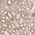 Immunohistochemical staining of human kidney shows moderate cytoplasmic positivity in cells in tubules.