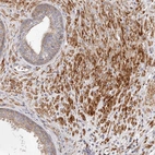 Immunohistochemical staining of human prostate shows moderate to strong cytoplasmic/membranous positivity in smooth muscle cells.