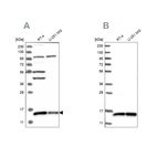 Western blot analysis using Anti-FAM136A antibody HPA030103 (A) shows similar pattern to independent antibody HPA030104 (B).