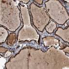 Anti-FAM136A Antibody