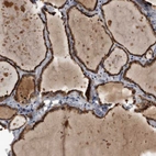 Anti-FAM136A Antibody