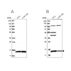 Western blot analysis using Anti-FAM136A antibody HPA030104 (A) shows similar pattern to independent antibody HPA030103 (B).