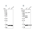 Western blot analysis using Anti-FAM136A antibody HPA030104 (A) shows similar pattern to independent antibody HPA030103 (B).