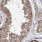 Anti-RWDD2A Antibody