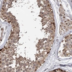Anti-RWDD2A Antibody