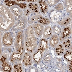 Anti-RWDD2A Antibody