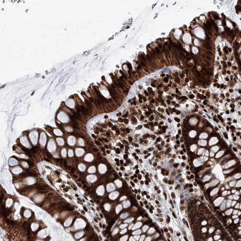 Anti-PAK1IP1 Antibody