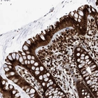 Anti-PAK1IP1 Antibody