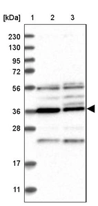 Lane 1: Marker [kDa] 230, 130, 95, 72, 56, 36, 28, 17, 11_br/_Lane 2: Human cell line RT-4_br/_Lane 3: Human cell line U-251MG sp